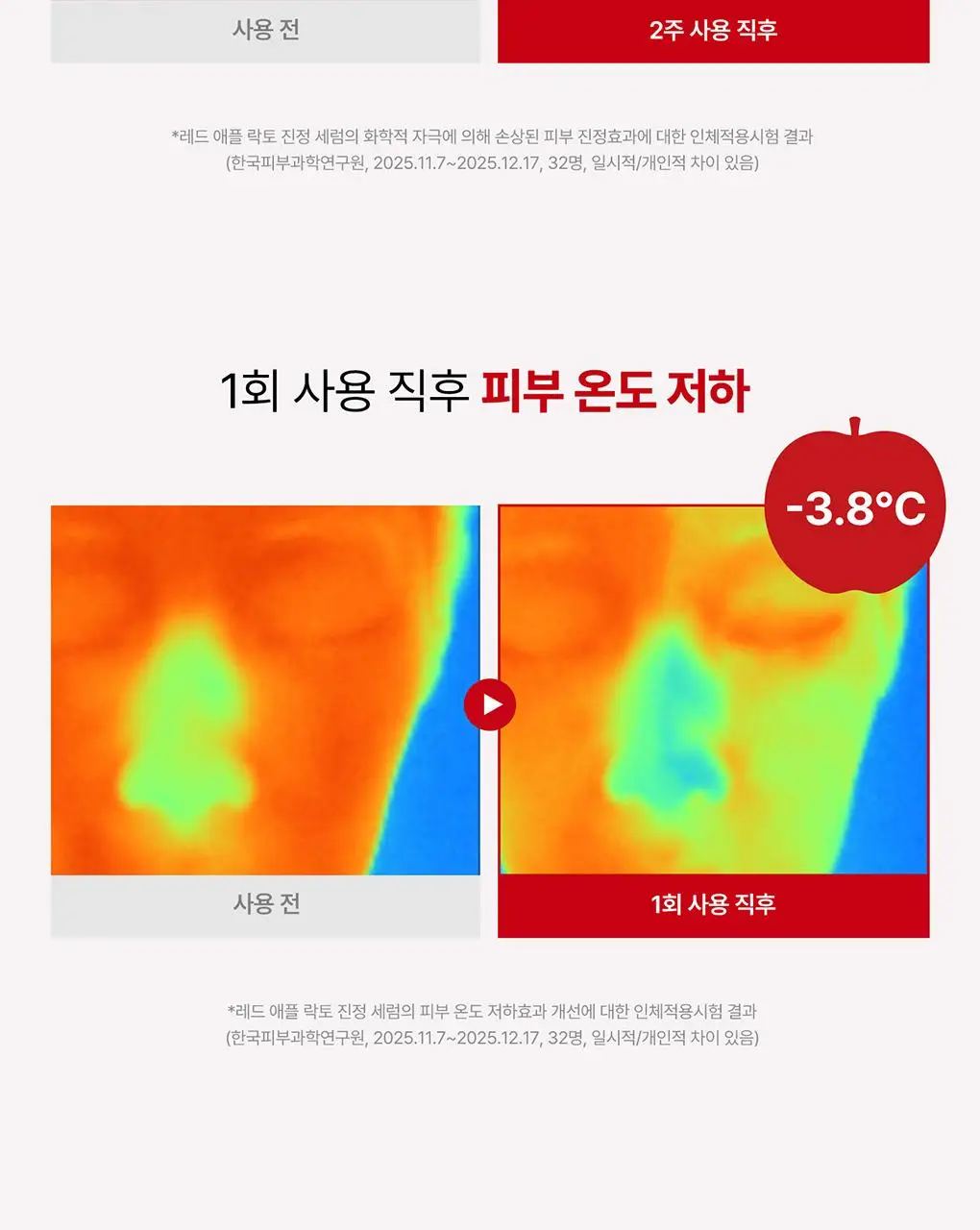 [NEW/단독기획] rdrd 레드 애플 락토 진정 세럼 30ml 응급진정 KIT 기획 상세페이지 28
